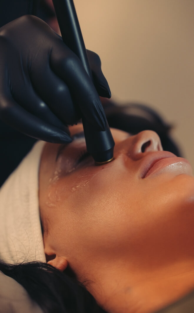 Woman getting a laser treatment